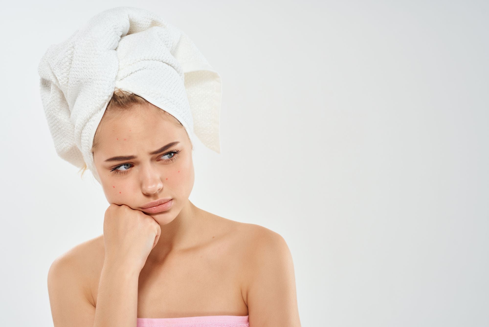 A girl suffering from acne sits after the shower wondering if peach slices acne spot dots really work.