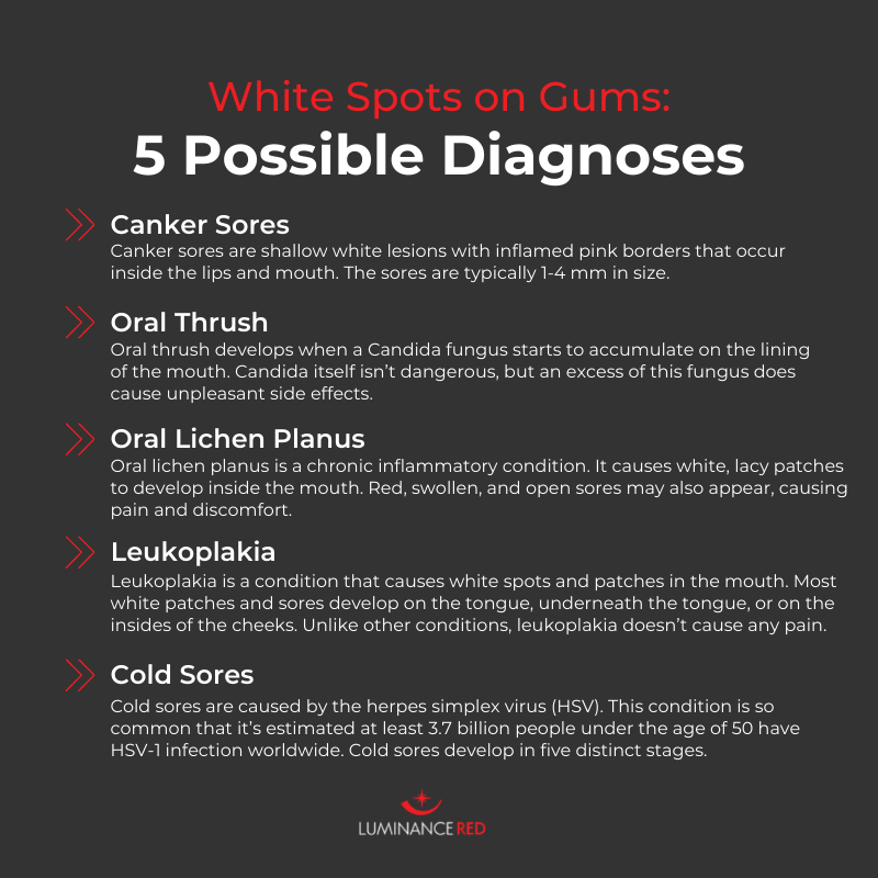 white spots on gums